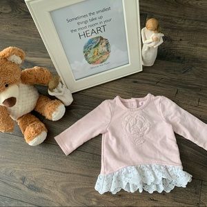 (8 for $20) 💛Infant Girl Floral and Lace Top